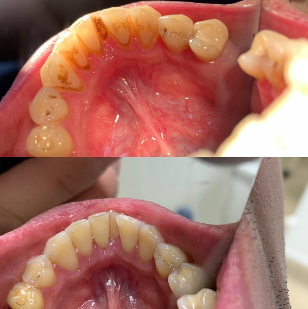 Стоматология доктора Коротчика - лечение зубов в Дубне