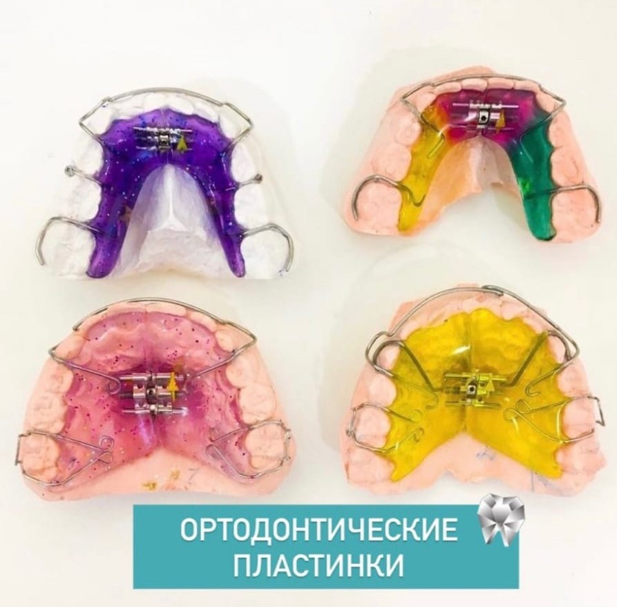 Ортодонтические пластинки в Уфе